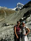 Les dames devant la dent